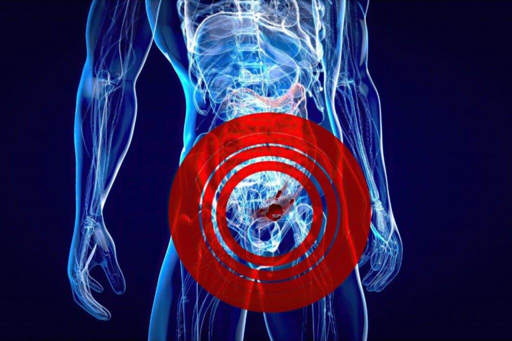 Calf thymus hormones inhibit the growth of colon tumors (May 2022)